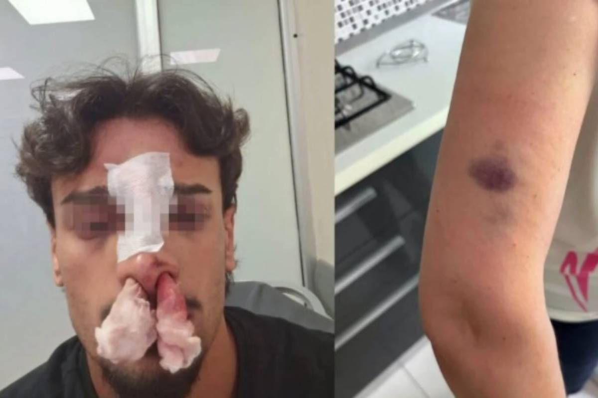 Occupano stallo disabili, poi picchiano madre e figlio